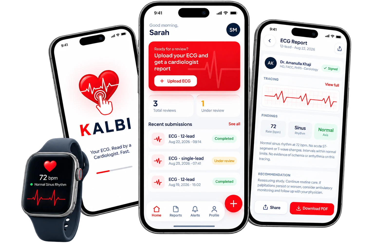 KALBI telecardiology app screens: ECG upload home, a cardiologist-signed ECG report, and an Apple Watch heart-rate reading