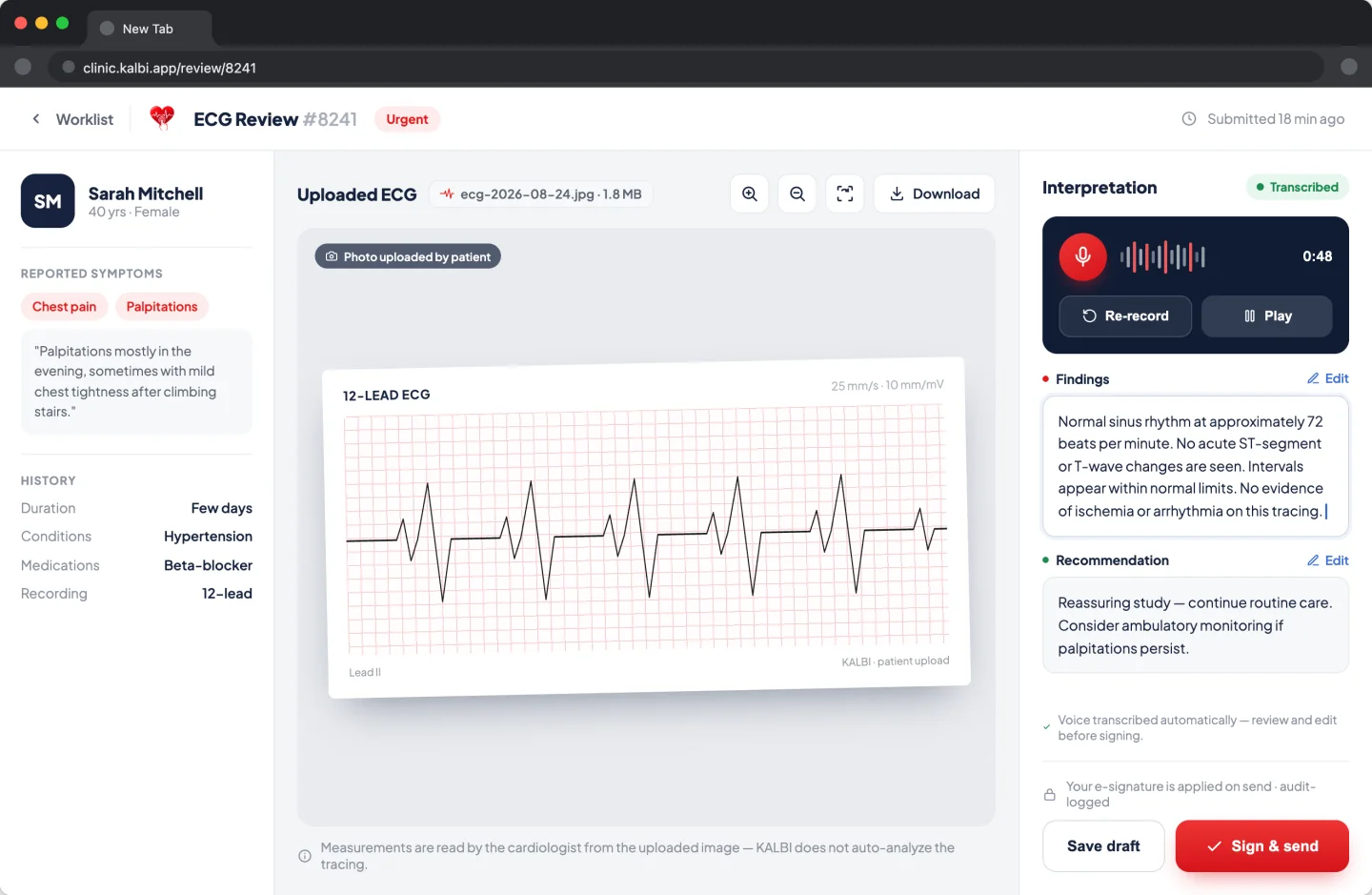 KALBI clinician portal ECG review screen with patient context, a full-resolution 12-lead tracing, voice dictation and a sign and send action