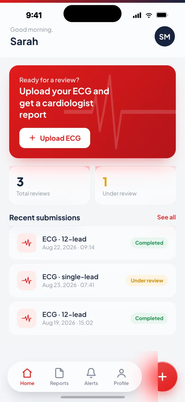 KALBI iOS home screen with an Upload ECG call to action and a list of recent ECG submissions with review status