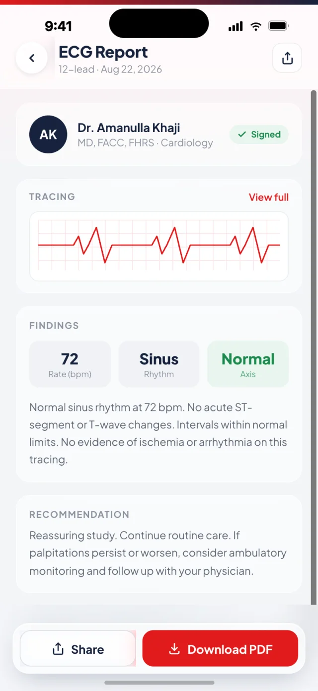 KALBI signed ECG report screen showing the reviewing cardiologist, the tracing, findings and a recommendation with a download PDF button