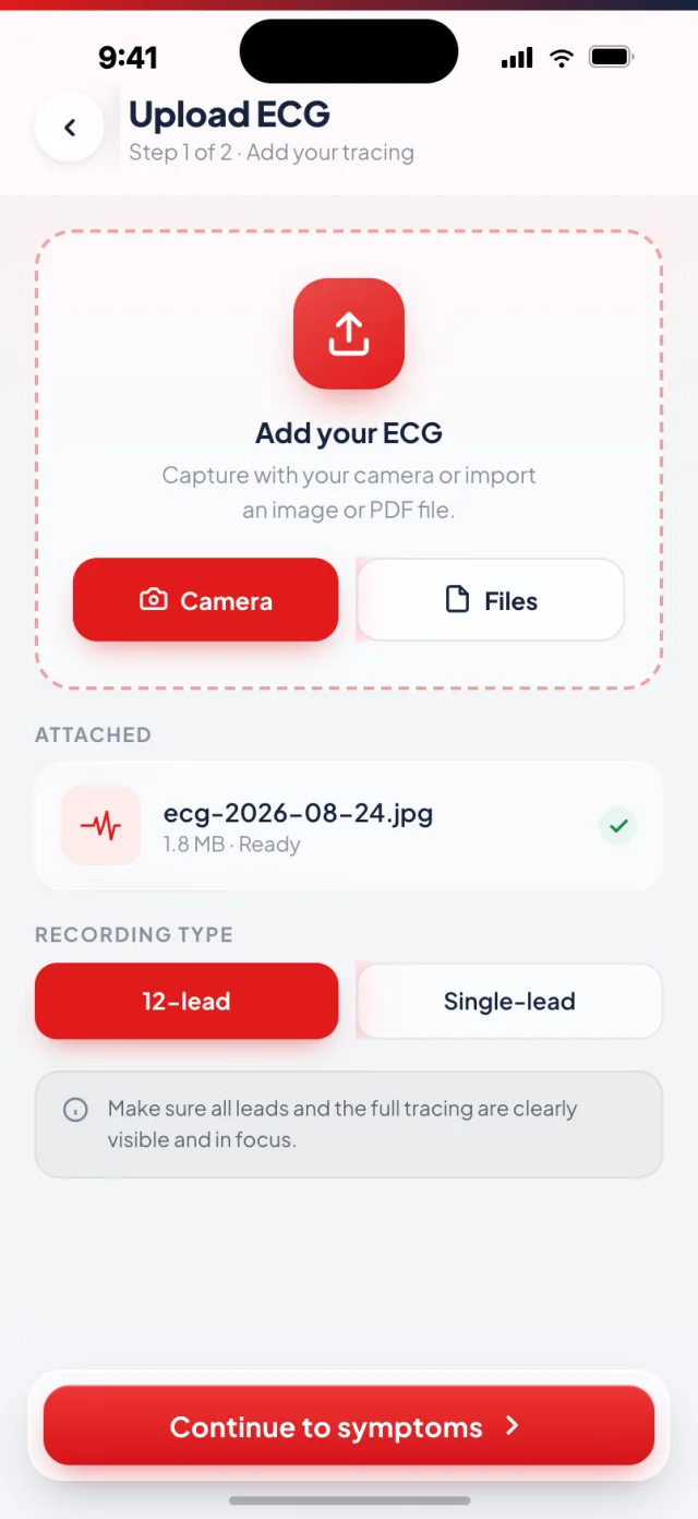 KALBI ECG upload screen offering camera capture or file import, with 12-lead and single-lead recording type options
